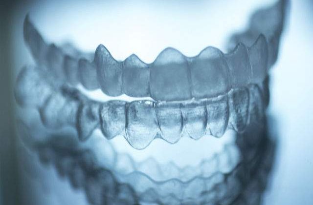 [FOTO] Un student si-a printat un aparat dentar 3D. A costat doar 60 dolari