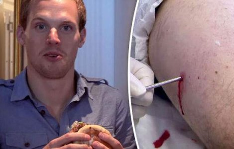 Experimentul macabru al unui barbat: si-a gustat propria carne