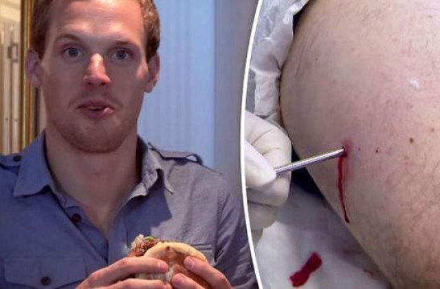 Experimentul macabru al unui barbat: si-a gustat propria carne