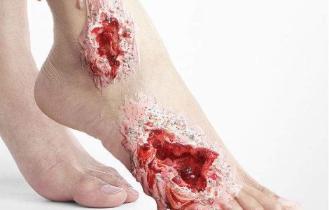  Foto  Efectele nocive ale zaharului prezentate intr-o campanie socanta