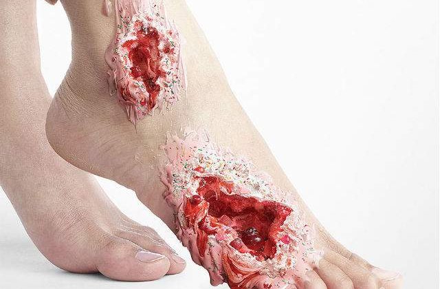 [FOTO] Efectele nocive ale zaharului prezentate intr-o campanie socanta