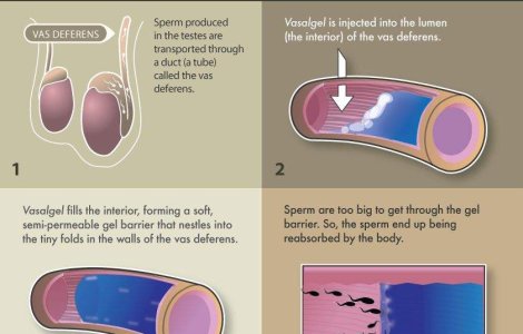Spuneti adio prezervativului si anticonceptionalelor!