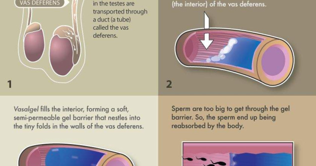 Spuneti adio prezervativului si anticonceptionalelor!
