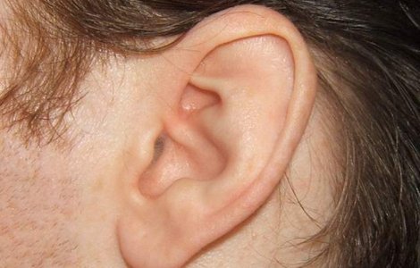  Video  De ce sa NU mai folosesti betisoare de vata pentru a-ti curata urechile