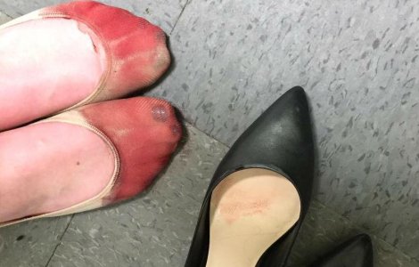 O femeie a fost fortata sa poarte tocuri pana a inceput sa sangereze