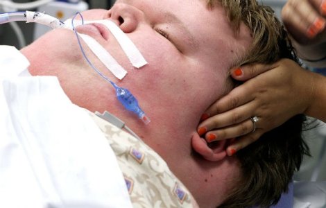 La 15 ani, cantarea 320 de kilograme. Uite cum arata acum