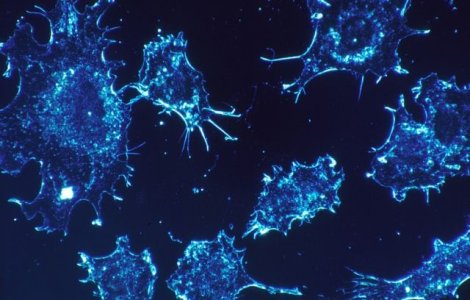 Noua modalitate de a trata cancerul, relevata de cercetatori