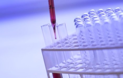 Comitetul Olimpic din Rusia: Opt atleti, depistati pozitiv dupa reexaminarea probelor de la J.O. 2012