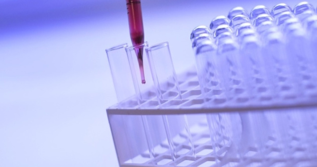 Comitetul Olimpic din Rusia: Opt atleti, depistati pozitiv dupa reexaminarea probelor de la J.O. 2012