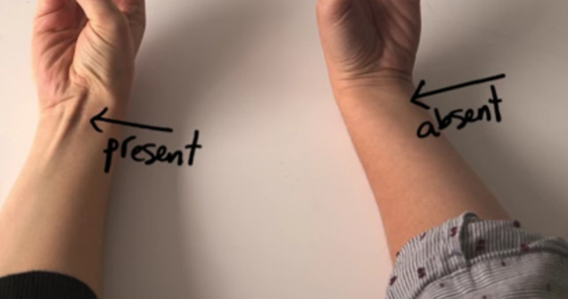  Video  Dovada evolutiei corpului uman poate fi umarita pe propriul trup