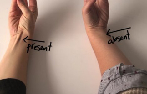  Video  Dovada evolutiei corpului uman poate fi umarita pe propriul trup