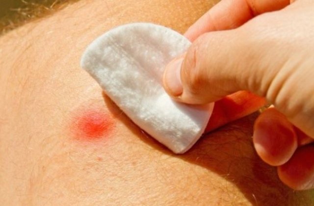 Cum ne protejam de insecte vara aceasta