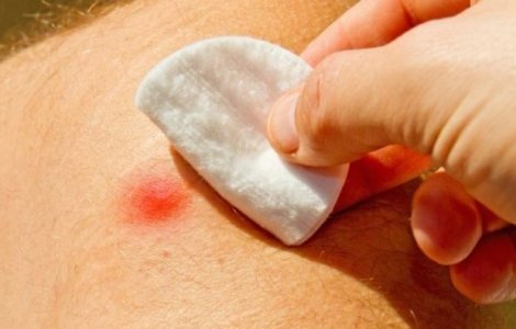 Cum ne protejam de insecte vara aceasta