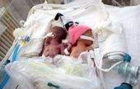 Bebelusii romani au cea mai mica rata de supravietuire din Europa