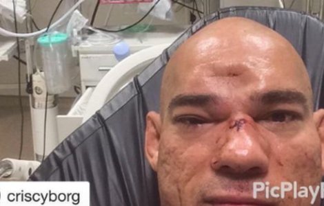  Video  Imagini horror de la gala MMA Londra! "I-a rupt capul"... la propriu