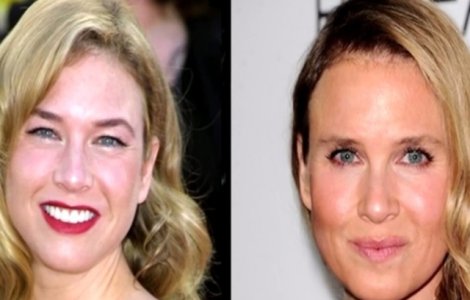  Top  S-au desfigurat! Cele mai nereusite operatii estetice