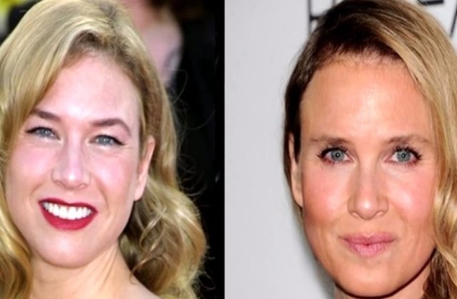 S-au desfigurat! Cum arata vedetele in urma celor mai nereusite operatii estetice