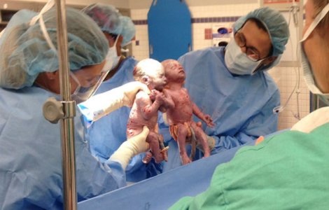 S-au nascut tinandu-se de mana si sunt in continuare de nedespartit