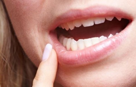 Bolile GRAVE ascunse de sangerarile gingivale