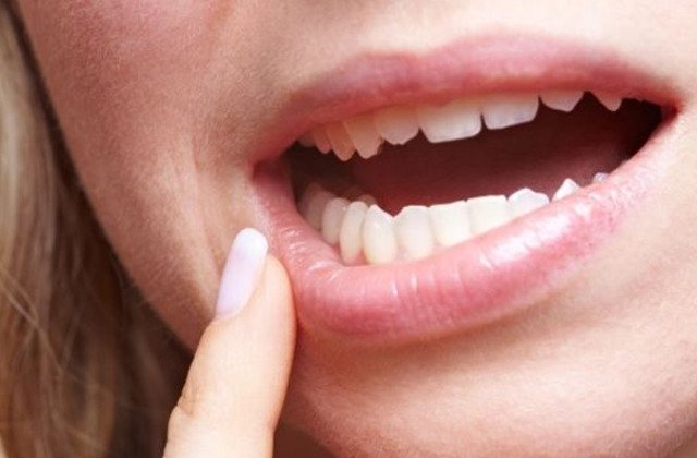 Bolile GRAVE ascunse de sangerarile gingivale