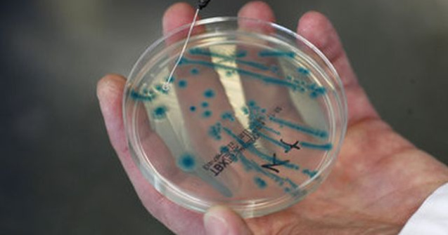 Bacteria E.Coli, descoperita in 9 abatoare din Valcea, Sibiu si Timis