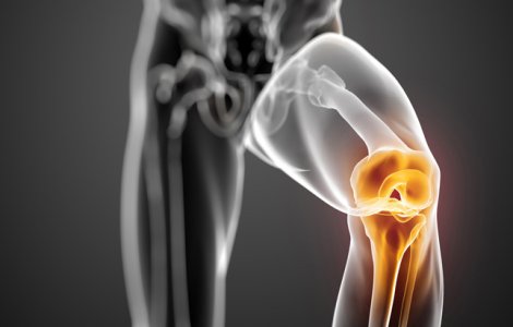 4 lucruri care dauneaza articulatiilor