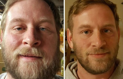 Fotografii inainte si dupa renuntarea la alcool