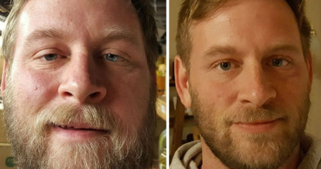 Fotografii inainte si dupa renuntarea la alcool