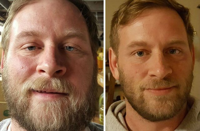 [FOTO] Transformari uluitoare. Fotografii inainte si dupa renuntarea la alcool