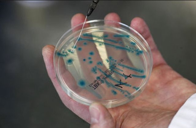 Carne si cascaval cu E. Coli, descoperite in magazine din Valcea si Teleorman