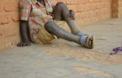 Virusul HIV da semne de oboseala