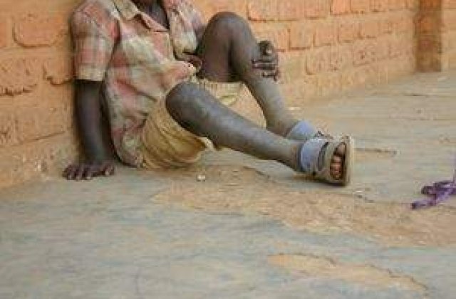 Virusul HIV da semne de oboseala