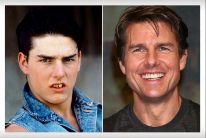 Tom Cruise