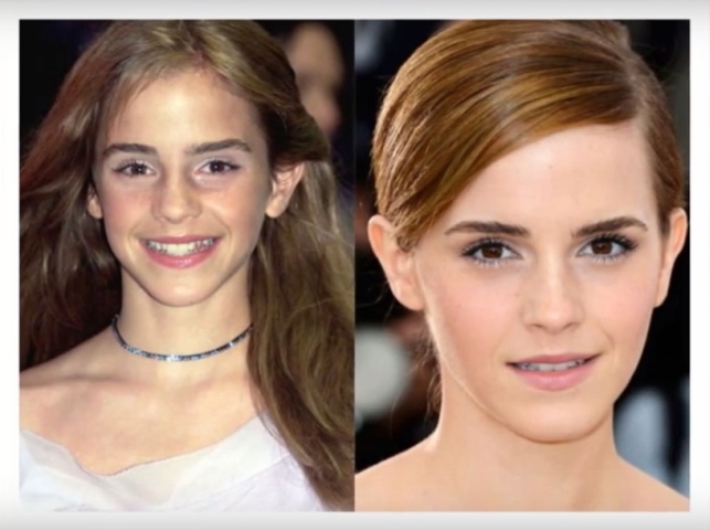 Emma Watson