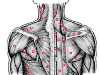 Remediu pentru durerile musculare