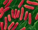Generalitati despre E.coli