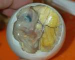 Balut, Filipine