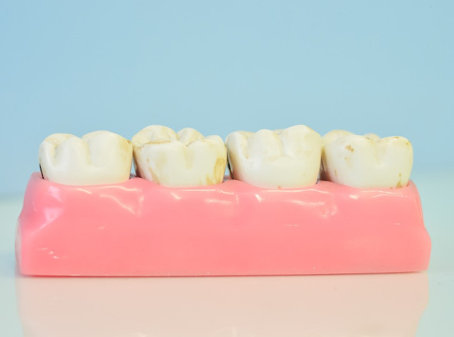 Ce simptome indica o infectie la nivelul masalei de minte?