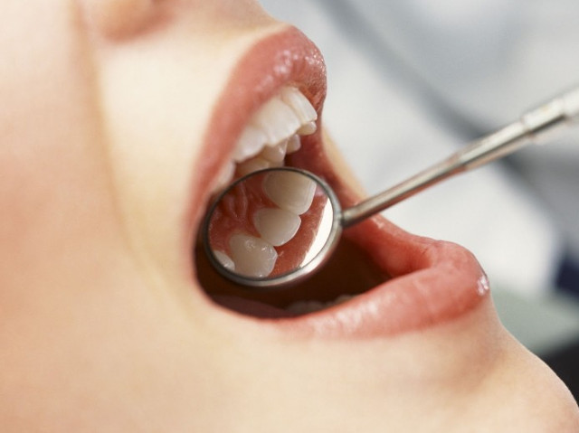 Cand suntem siguri ca extractia este cea mai buna solutie?