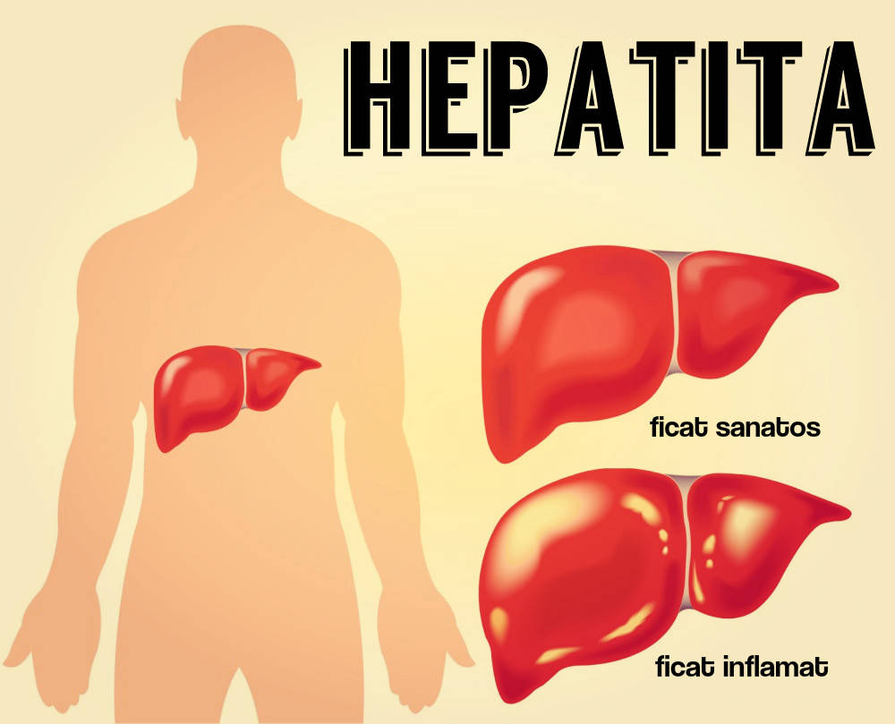 1. Hepatita