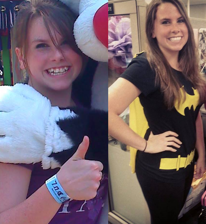 Nu subestimati puterea unui ortodont si a unui aparat dentar