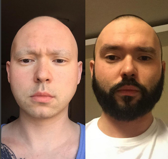 Un artist tatoo a invins cancerul