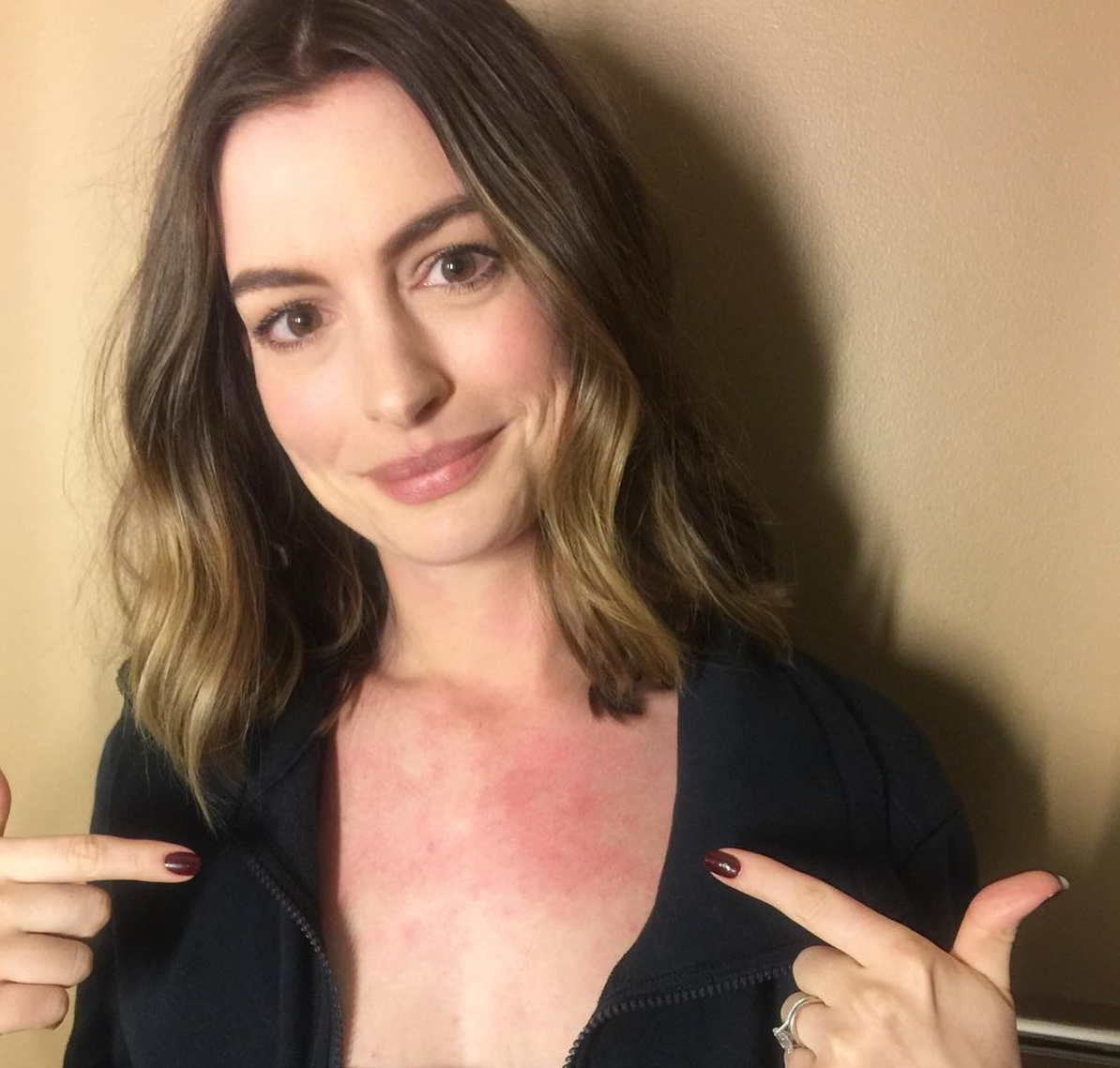 Actrita Ann Hathaway se inroseste pe piept din cauza emotiilor, inainte de a intra in direct la tv