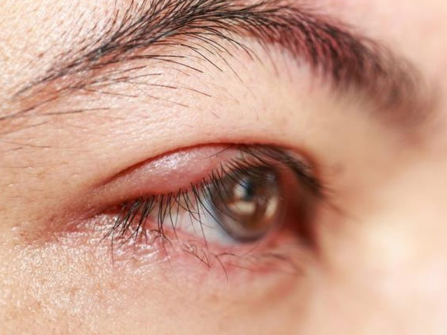 Are proprietati antiinflamatorii - Mentine sanatatea fizica generala