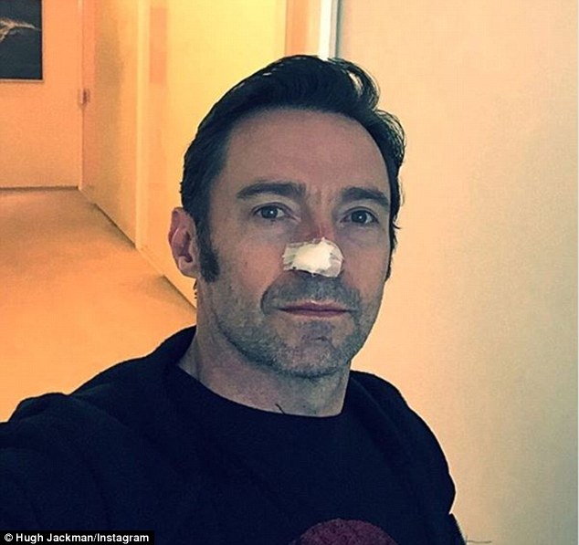 Actorul Hugh Jackman a invins cancerul de 6 ori