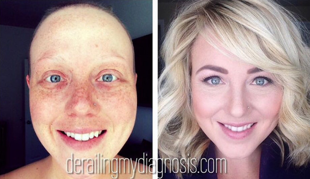 Dupa 4 recidive ale bolii, 4 operatii, 55 de sedinte de chimioterapie, 28 de sedinte de radioterapie, se poate bucura din nou de viata.