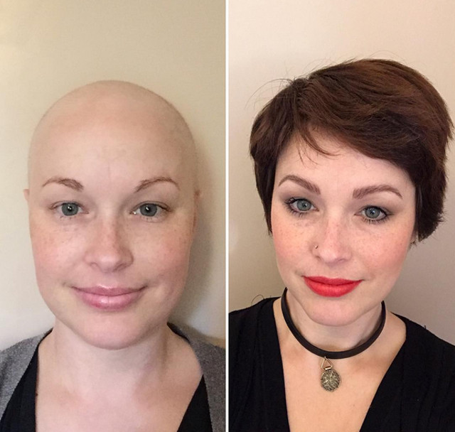 Vindecarea i-a readus zambetul pe care il credea pierdut pentru totdeauna