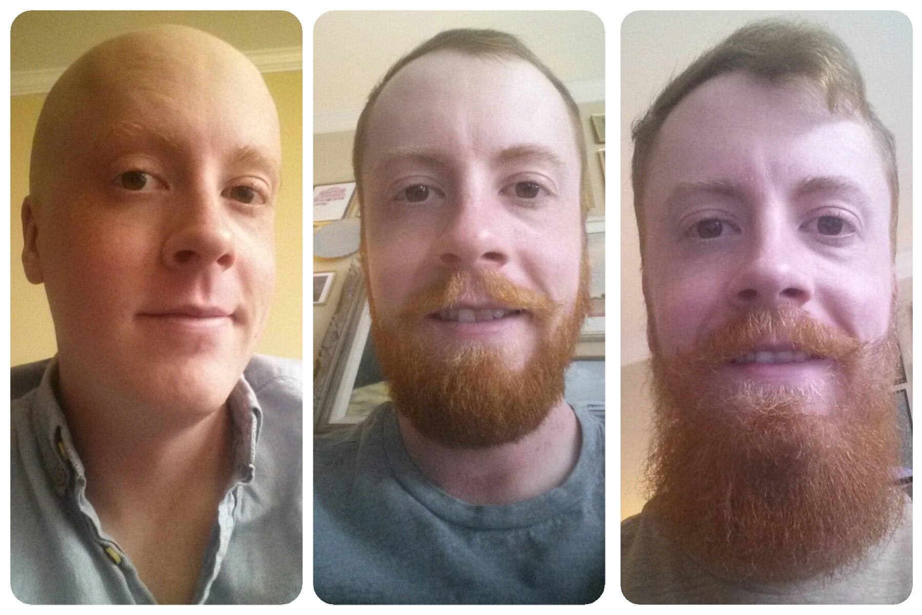 Cancerul nu l-a invins!