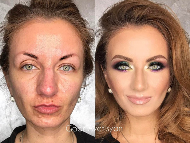 Pete rosiatice si oboseala