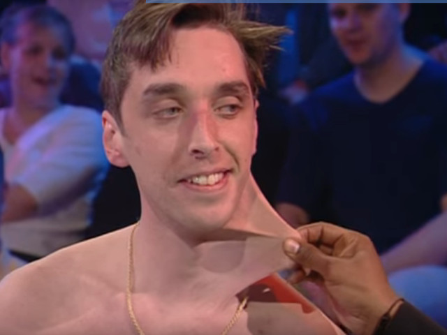 Garry Turner are cea mai flexibila piele